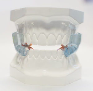 Oral Appliance Therapy new jersey