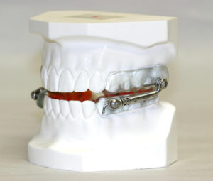 oral appliance for sleep apnea new jersey